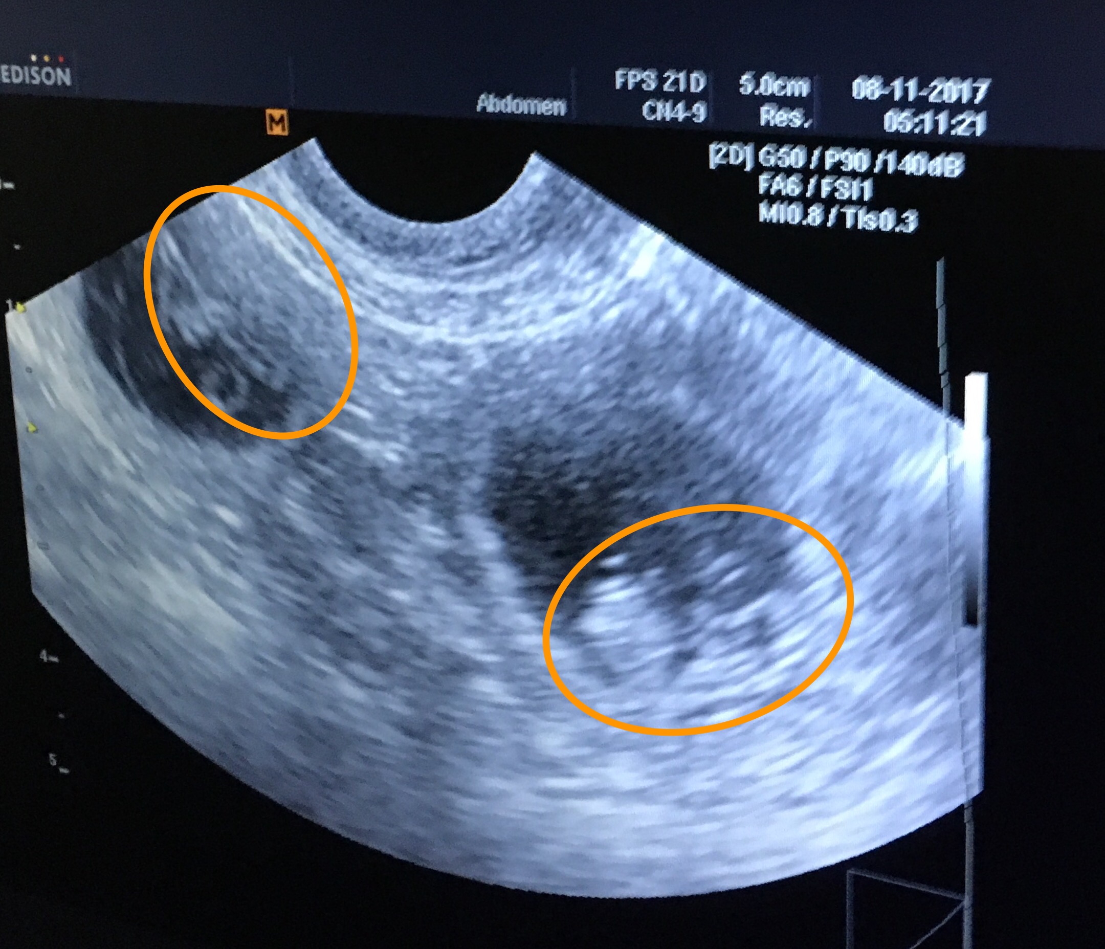 Charlie%20x%20Daisy%20ultrasound